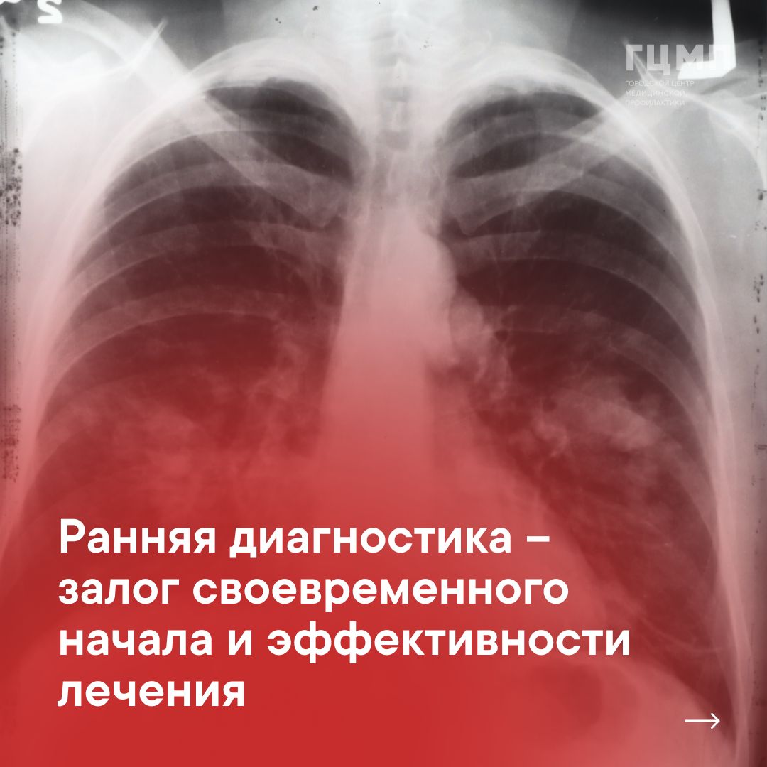 Профилактика рака лёгких